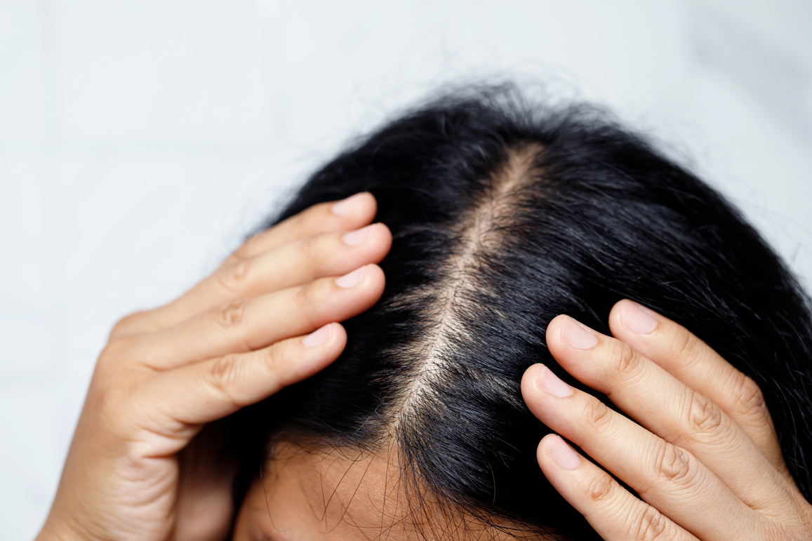 Woman Showing Her Scalp Up Close